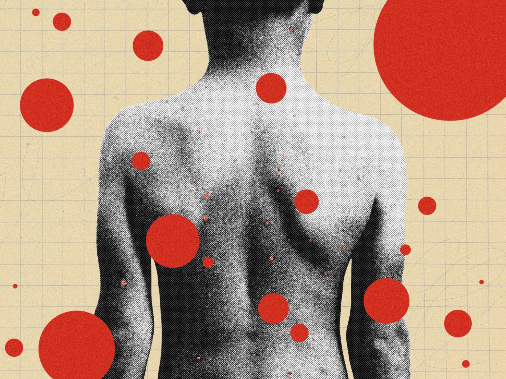 The Backward Logic of Chickenpox Parties