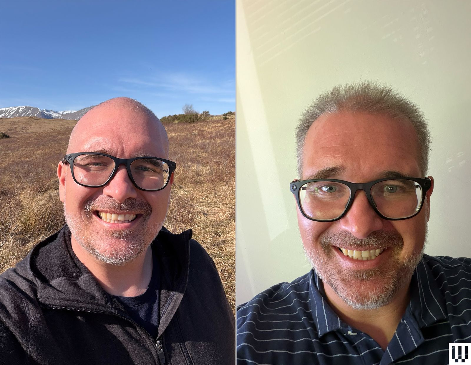 GroWell Cap Review: I Have Hair for the First Time in 15 Years